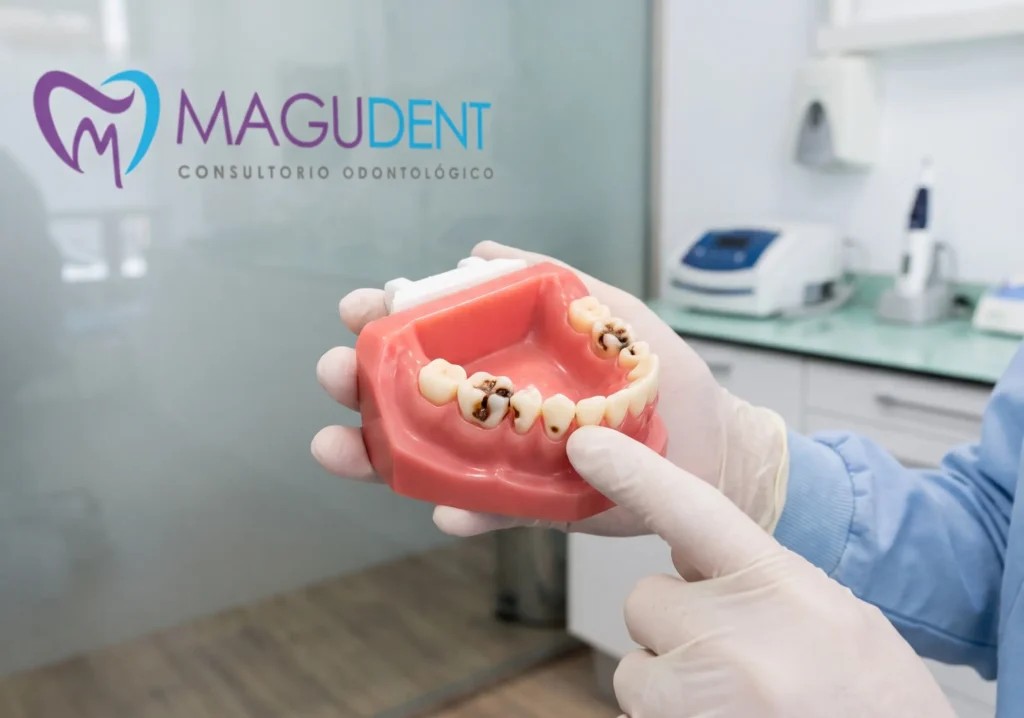 Un especialista de Magudent mostrando un modelo educativo de una dentadura con caries para explicar cómo se forman y cómo prevenirlas.