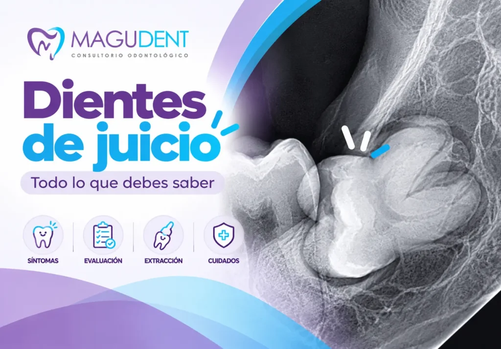 Dientes de juicio o terceras molares