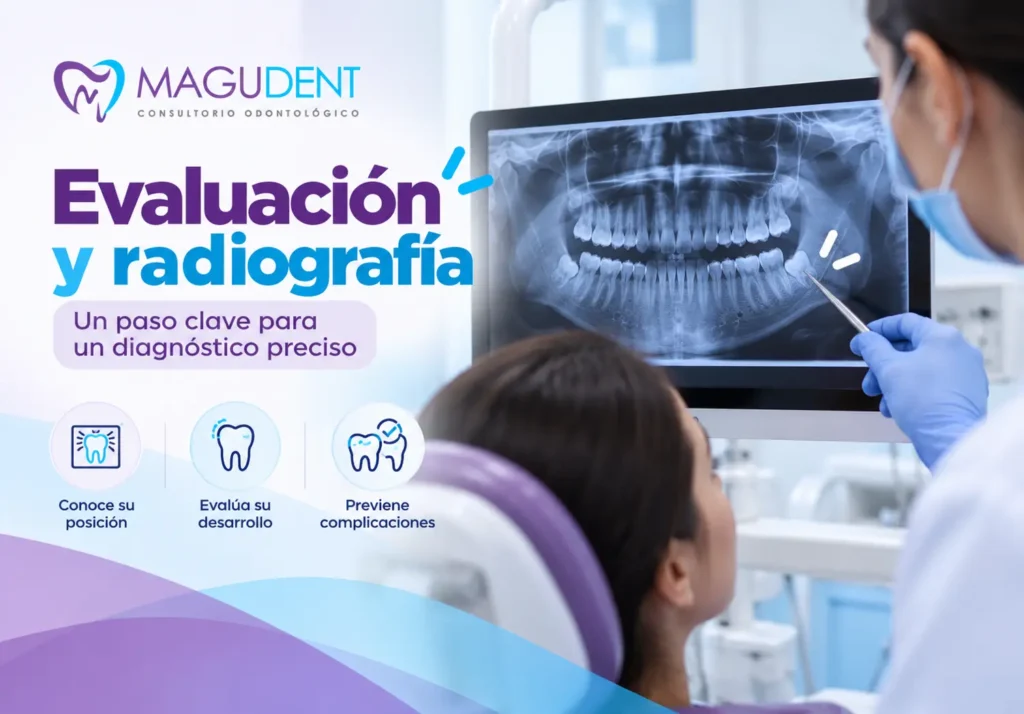 Radiografía de dientes de juicio o tercera molar